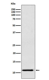 Anti-fetal hemoglobin Rabbit Monoclonal Antibody Boster Bio