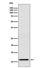 Anti-fetal hemoglobin Rabbit Monoclonal Antibody Boster Bio