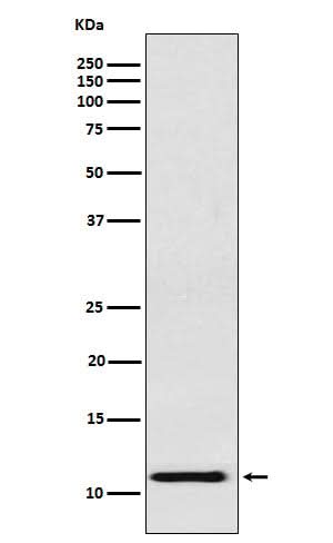 Anti-fetal hemoglobin Rabbit Monoclonal Antibody Boster Bio