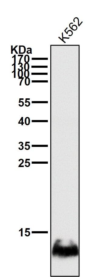 Anti-HBG1/2 Rabbit Monoclonal Antibody Boster Bio