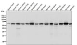 Anti-KAT9 / Elp3 Rabbit Monoclonal Antibody Boster Bio