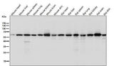 Anti-KAT9 / Elp3 Rabbit Monoclonal Antibody Boster Bio
