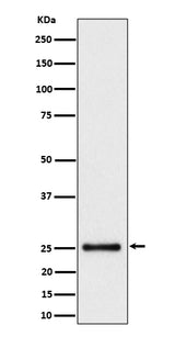 Anti-HMG4 Rabbit Monoclonal Antibody Boster Bio