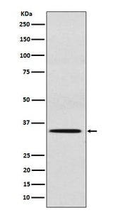 Anti-SULT2A1 Rabbit Monoclonal Antibody Boster Bio