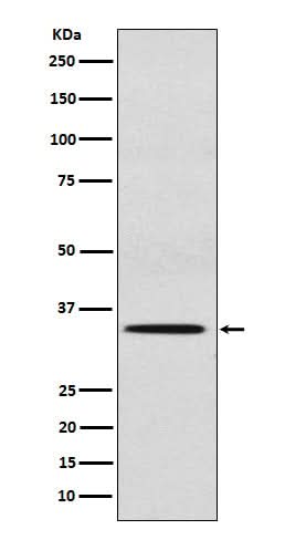 Anti-SULT2A1 Rabbit Monoclonal Antibody Boster Bio