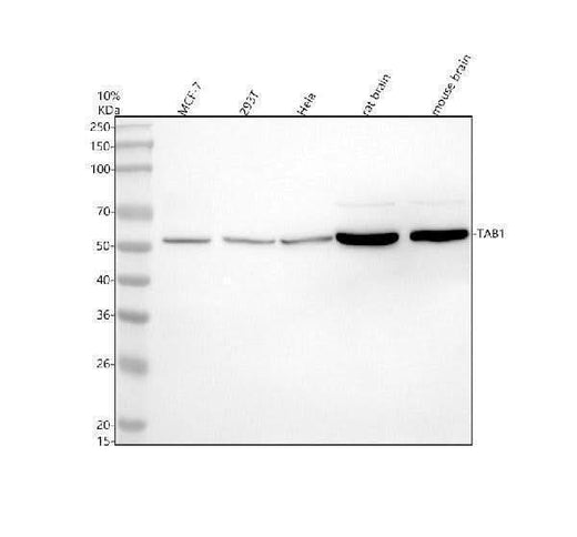 Anti-TAB1 Rabbit Monoclonal Antibody Boster Bio