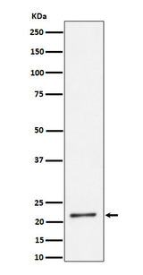 Anti-K27-linkage Specific Ubiquitin Rabbit Monoclonal Antibody Boster Bio