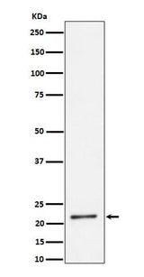 Anti-K27-linkage Specific Ubiquitin Rabbit Monoclonal Antibody Boster Bio
