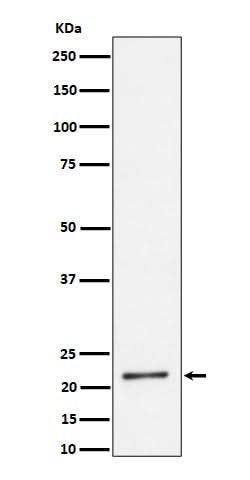 Anti-K27-linkage Specific Ubiquitin Rabbit Monoclonal Antibody Boster Bio