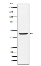 Anti-HSD3B1 Rabbit Monoclonal Antibody Boster Bio