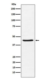 Anti-HSD3B1 Rabbit Monoclonal Antibody Boster Bio