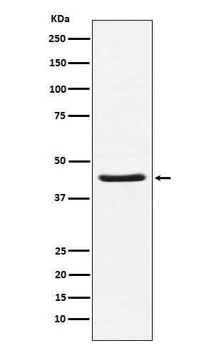 Anti-HSD3B1 Rabbit Monoclonal Antibody Boster Bio