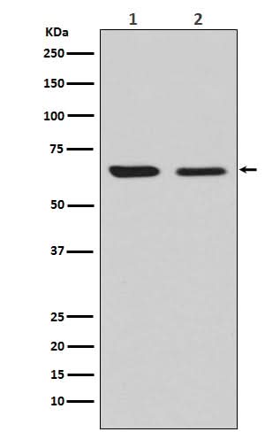 Anti-CRMP2 Rabbit Monoclonal Antibody Boster Bio
