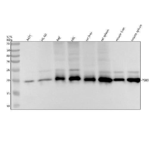 Anti-PSB9 / LMP2 Rabbit Monoclonal Antibody Boster Bio