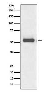 Anti-TRK fused gene TFG Rabbit Monoclonal Antibody Boster Bio