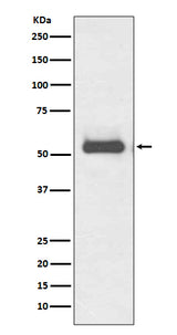 Anti-TRK fused gene TFG Rabbit Monoclonal Antibody Boster Bio