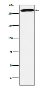 Anti-PRPF8 Rabbit Monoclonal Antibody Boster Bio