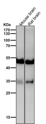 Anti-ACVR1B Rabbit Monoclonal Antibody Boster Bio