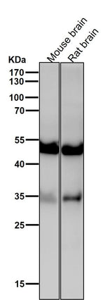 Anti-ACVR1B Rabbit Monoclonal Antibody Boster Bio