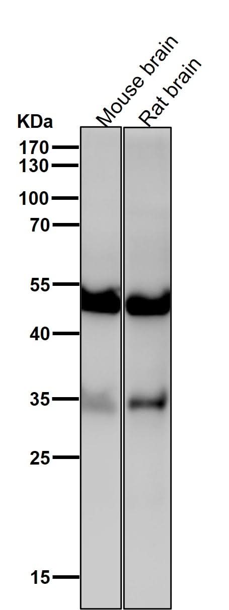 Anti-ACVR1B Rabbit Monoclonal Antibody Boster Bio