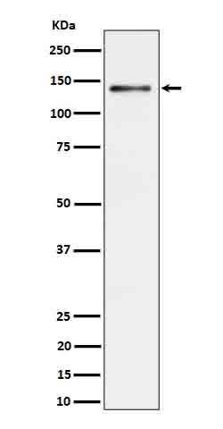Anti-Ceruloplasmin Rabbit Monoclonal Antibody Boster Bio