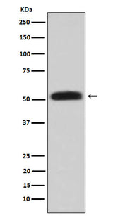 Anti-Glycerol kinase Rabbit Monoclonal Antibody Boster Bio