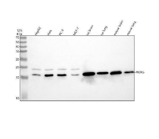 Anti-Peroxiredoxin 5 Rabbit Monoclonal Antibody Boster Bio