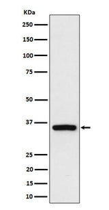 Anti-Rad51D Rabbit Monoclonal Antibody Boster Bio