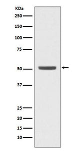 Anti-E2F2 Rabbit Monoclonal Antibody Boster Bio