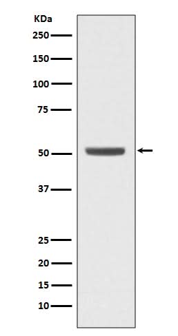 Anti-E2F2 Rabbit Monoclonal Antibody Boster Bio