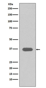 Anti-MSI2/Musashi 2 Rabbit Monoclonal Antibody Boster Bio