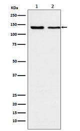 Anti-Exportin 5 Rabbit Monoclonal Antibody Boster Bio