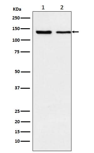 Anti-Exportin 5 Rabbit Monoclonal Antibody Boster Bio