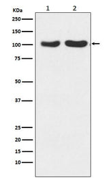 Anti-GluR2+GluR3 Rabbit Monoclonal Antibody Boster Bio