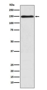 Anti-COL11A1 Rabbit Monoclonal Antibody Boster Bio