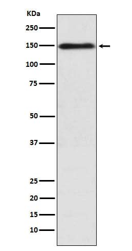 Anti-COL11A1 Rabbit Monoclonal Antibody Boster Bio