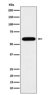 Anti-TUB1 Rabbit Monoclonal Antibody Boster Bio