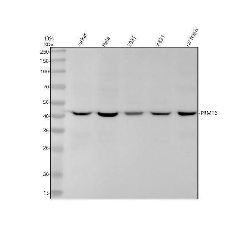 Anti-PRMT6 Rabbit Monoclonal Antibody Boster Bio