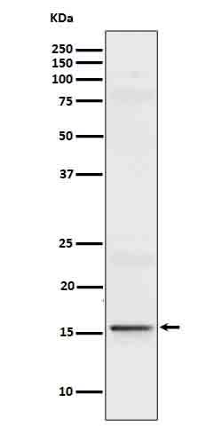 Anti-IL9 Rabbit Monoclonal Antibody Boster Bio
