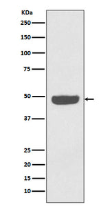 Anti-NSE ENO2 Rabbit Monoclonal Antibody Boster Bio