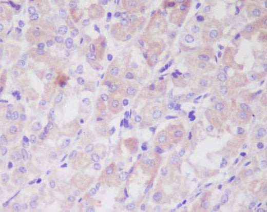 Anti-ILK/Integrin Linked Ilk Rabbit Monoclonal Antibody Boster Bio