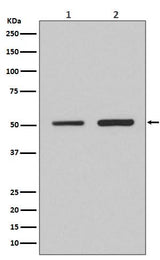 Anti-IRF2 Rabbit Monoclonal Antibody Boster Bio