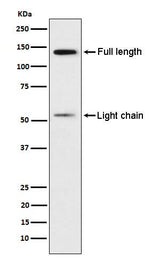 Anti-Kininogen 1 Rabbit Monoclonal Antibody Boster Bio