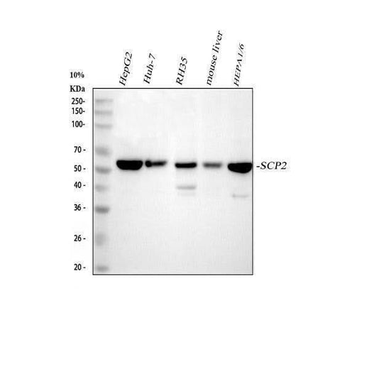 Anti-Sterol carrier protein 2 Rabbit Monoclonal Antibody Boster Bio