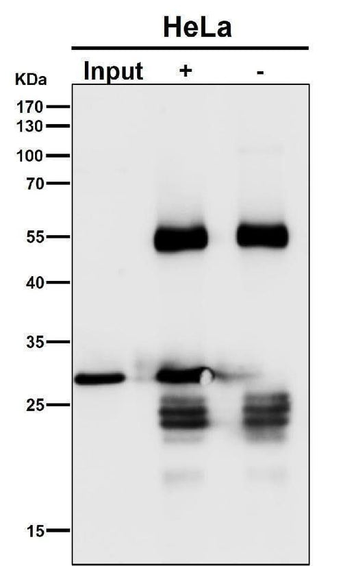 Anti-GCLM Rabbit Monoclonal Antibody Boster Bio