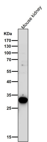 Anti-GCLM Monoclonal Antibody Boster Bio