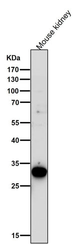 Anti-GCLM Monoclonal Antibody Boster Bio