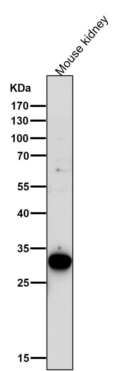 Anti-GCLM Monoclonal Antibody Boster Bio