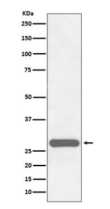 Anti-CITED2 Rabbit Monoclonal Antibody Boster Bio