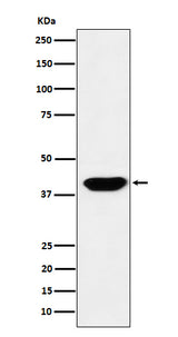 Anti-Islet1 Monoclonal Antibody Boster Bio